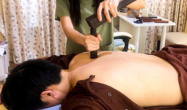 トークセン施術の様子２